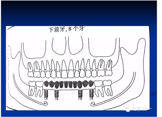 QQ圖片20150803110352.png