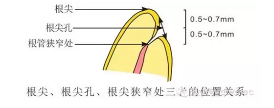 讓你知道根管測(cè)量受影響的原因