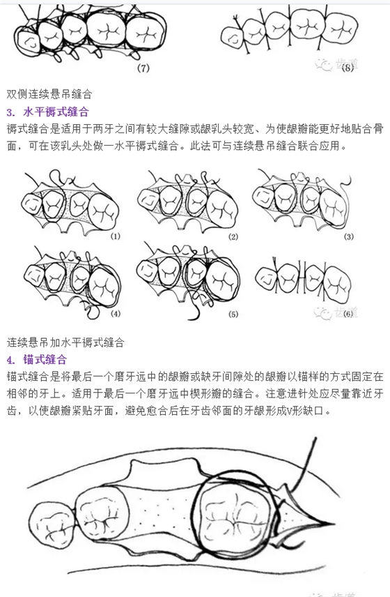 牙醫(yī)基本技能：口內(nèi)縫合術(shù)（文字、示意圖及視頻）