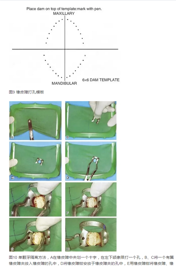 橡皮障隔離之單顆牙隔離方法——陳智教授