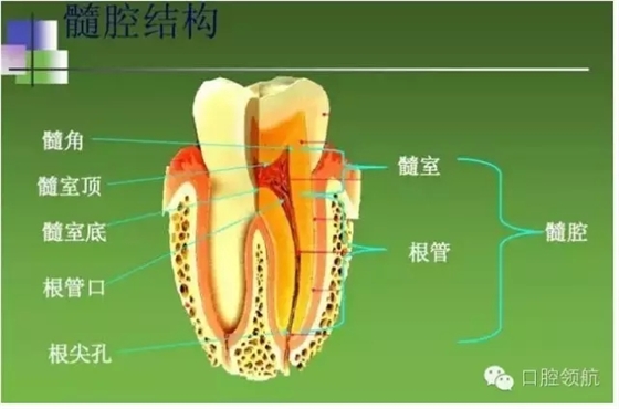 開髓術(shù)