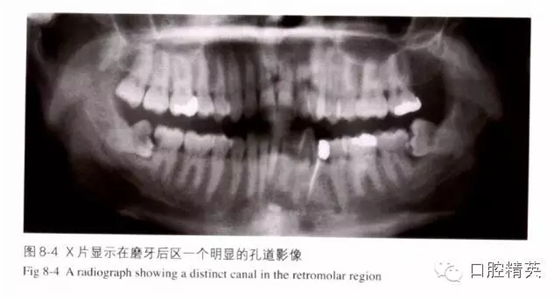 分析局部麻醉失敗的常見(jiàn)原因