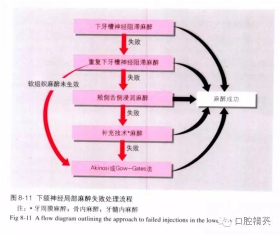 分析局部麻醉失敗的常見(jiàn)原因