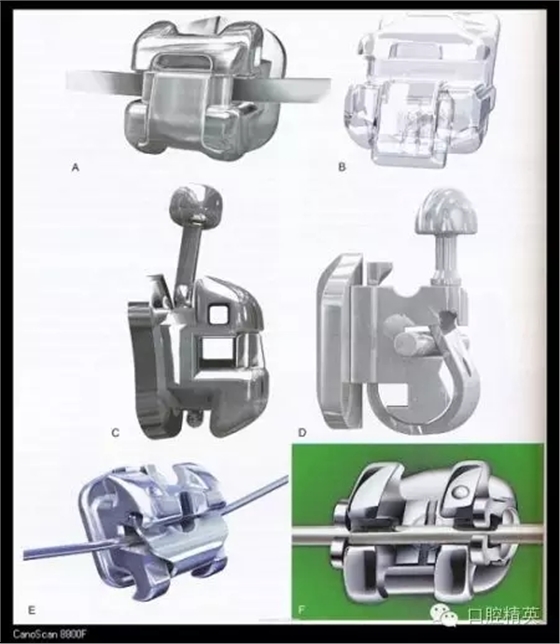 解決牙齒不齊的十八般武器