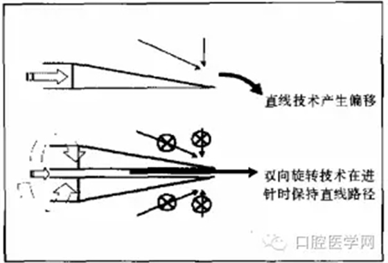 即使是老手也會失手的麻醉----下牙槽、舌、頰一次阻滯麻醉