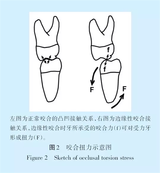 王美青.淺談咬合修復(fù)重建中的（牙合）學(xué)問題