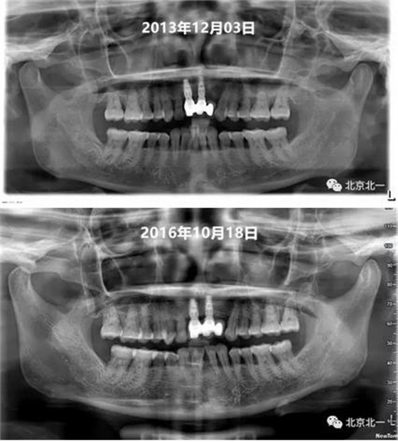 360截圖20170124115247233.jpg