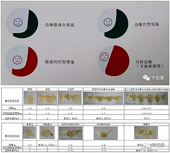 影響全瓷牙冠裂的因素有哪些？