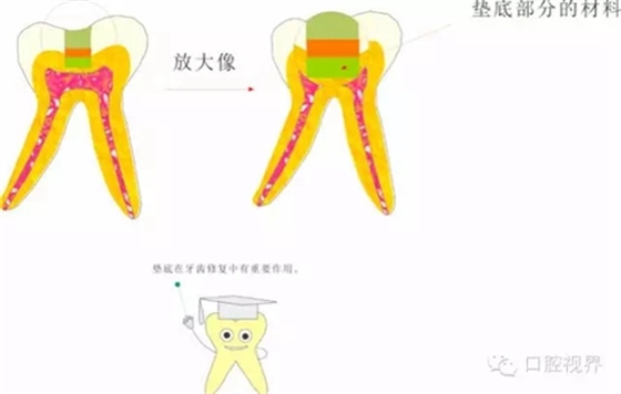 【愛牙科普知識(shí)300問(wèn)】 “什么是活髓切斷術(shù)？”