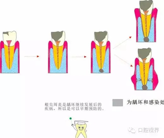 【愛(ài)牙科普知識(shí)300問(wèn)】 “什么是牙本質(zhì)敏感？”