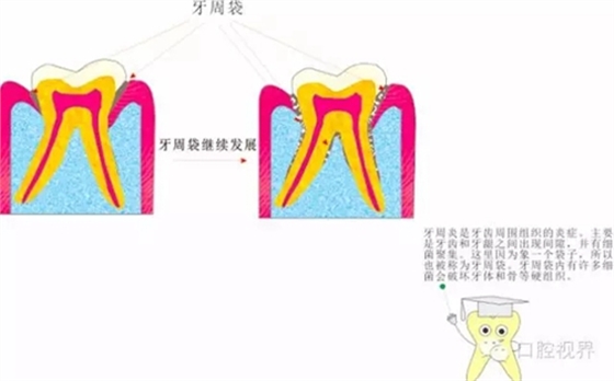 【愛(ài)牙科普知識(shí)300問(wèn)】 “什么是牙本質(zhì)敏感？”