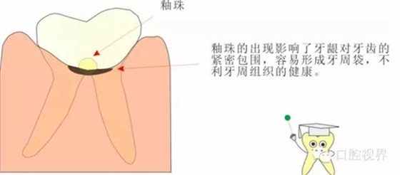 【愛牙科普知識300問】 “什么是融合牙、愈合牙和雙生牙？”