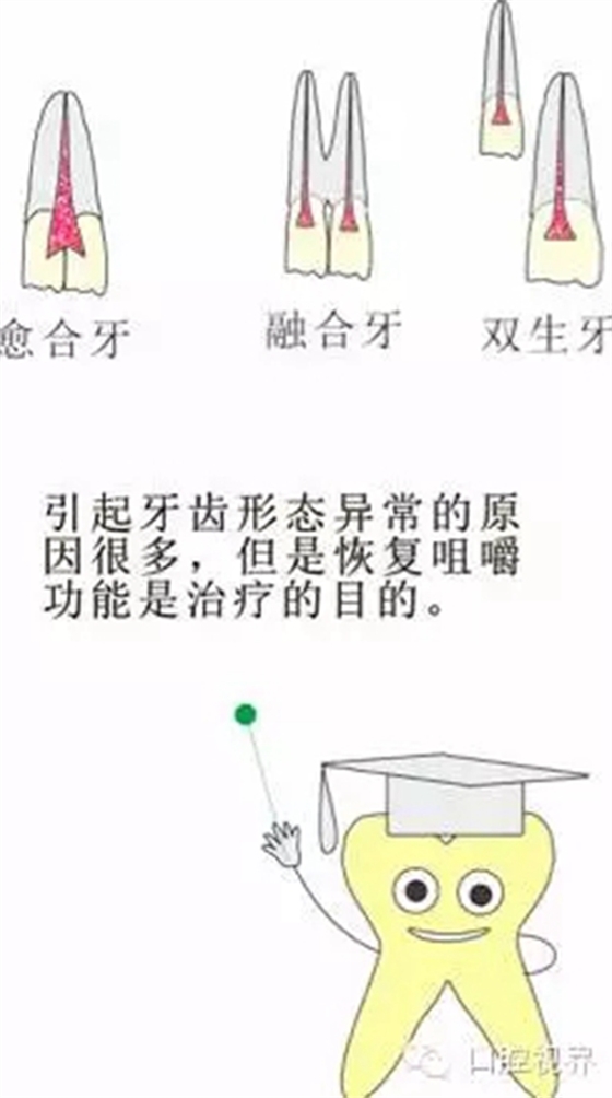 【愛牙科普知識300問】 “什么是融合牙、愈合牙和雙生牙？”