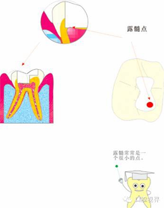 【愛牙科普知識300問】 “什么是融合牙、愈合牙和雙生牙？”