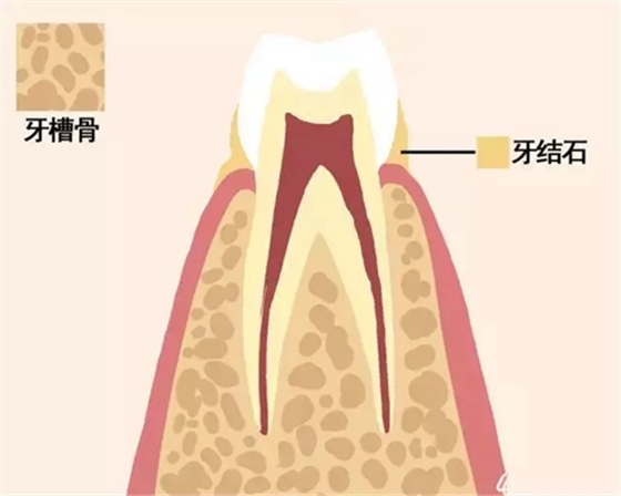 【愛牙科普】牙齒是如何脫落的…