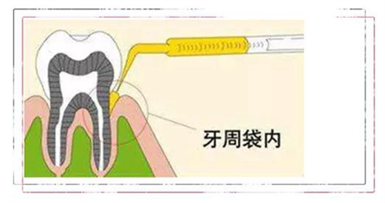 上海品瑞邁格磁致伸縮治療儀