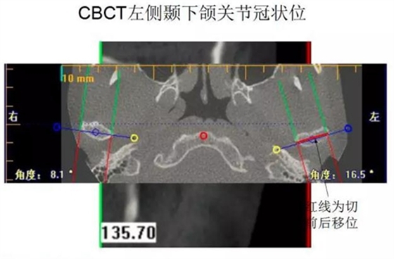 	口腔修復治療中，常見臨床接診流程