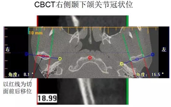 	口腔修復治療中，常見臨床接診流程