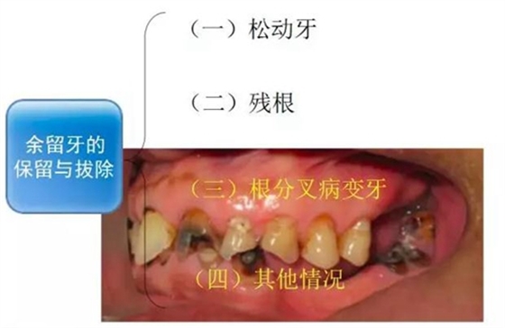 	口腔修復治療中，常見臨床接診流程