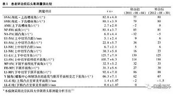 尖牙完全唇側(cè)錯位擁擠，矯正1例  