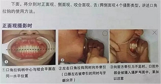 口腔攝影方法與技巧