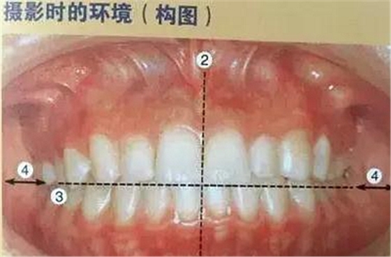 口腔攝影方法與技巧