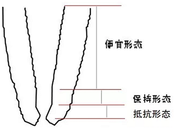 知識(shí)分享：規(guī)范化根管治療的細(xì)節(jié)分析