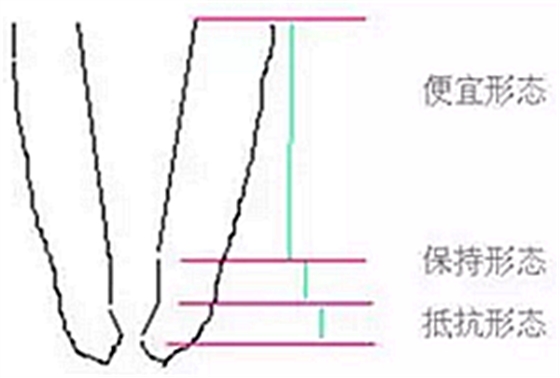 知識分享：根管治療的標(biāo)準(zhǔn)步驟