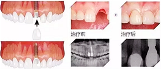 你總?cè)轮囱?ldquo;貴”還不是你自己造成的