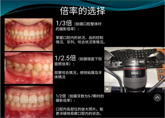 口內(nèi)照攝影方法與技巧分享