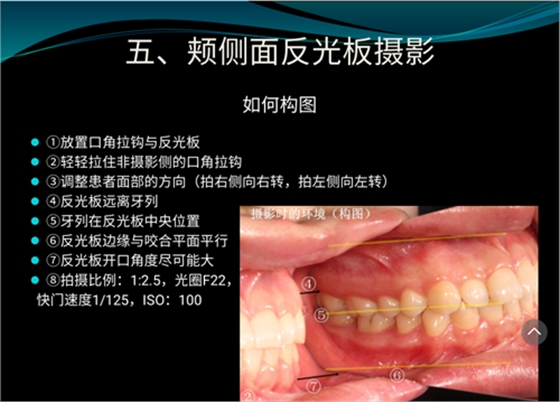 口內(nèi)照攝影方法與技巧分享