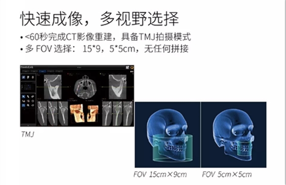 費(fèi)森影像