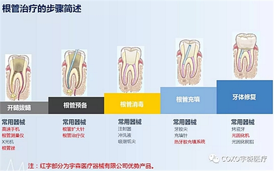 廠(chǎng)家來(lái)解說(shuō)：多頻技術(shù)的根管長(zhǎng)度測(cè)定儀