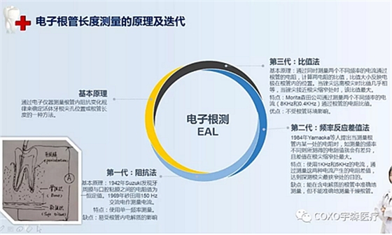 多頻技術(shù)的根管長(zhǎng)度測(cè)定儀