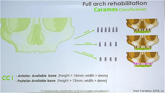 【熱點(diǎn)回顧】帶您深度了解無牙頜種植修復(fù)——Pro Arch