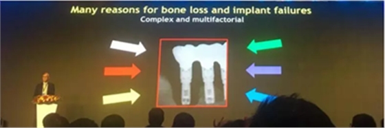 【聽(tīng)課筆記】種植體周?chē)俏找蛩匮芯颗c臨床意義