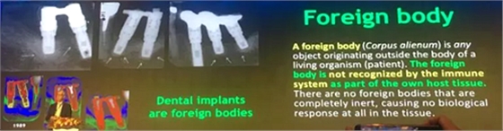 【聽(tīng)課筆記】種植體周?chē)俏找蛩匮芯颗c臨床意義