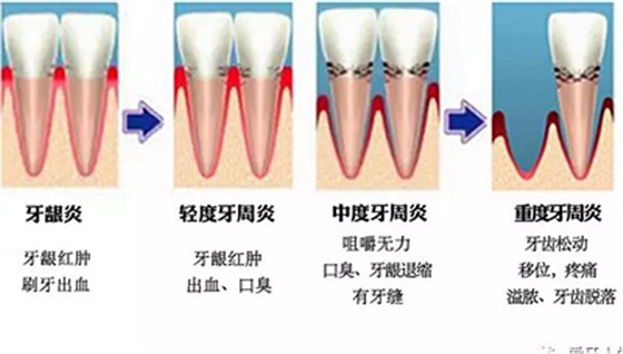 牙齦萎縮怎么辦？