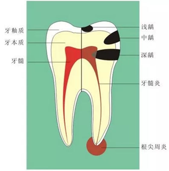 牙齦萎縮怎么辦？