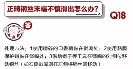 	 牙醫(yī)停診了？別怕，請您收下這份居家牙科急癥指南！