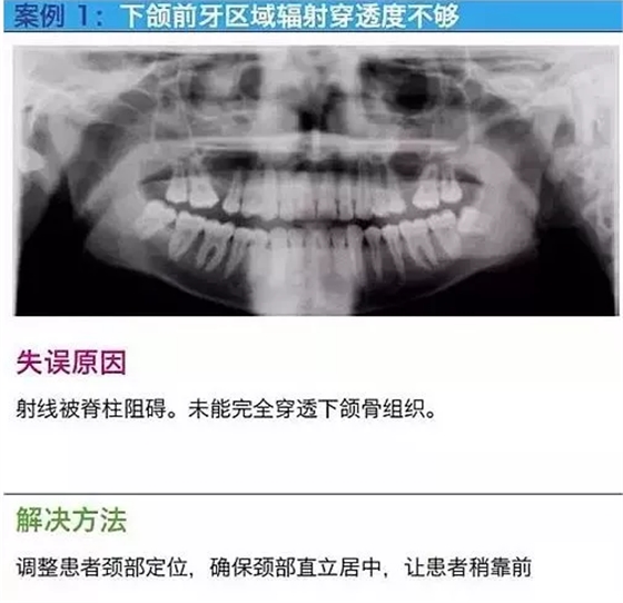 曲斷的10大經(jīng)典失誤案例及原因分析！