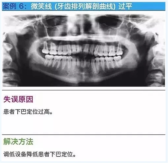 曲斷的10大經(jīng)典失誤案例及原因分析！