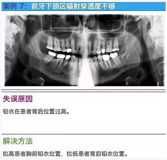 曲斷的10大經(jīng)典失誤案例及原因分析！