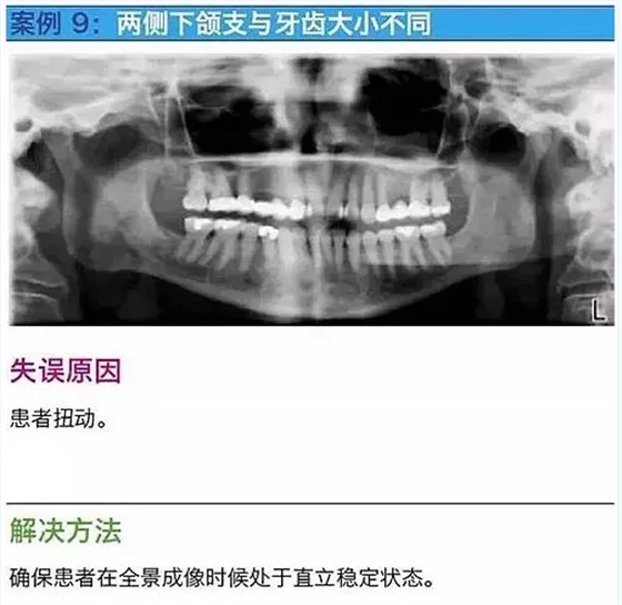 曲斷的10大經(jīng)典失誤案例及原因分析！