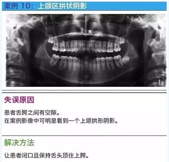 曲斷的10大經(jīng)典失誤案例及原因分析！