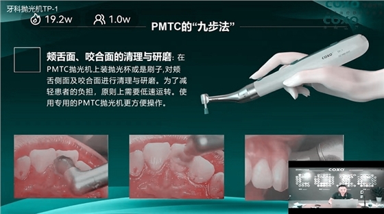 頰舌面、咬合面的清理與研磨