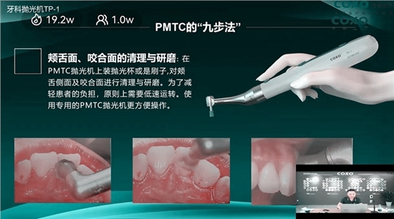 頰舌面、咬合面的清理與研磨