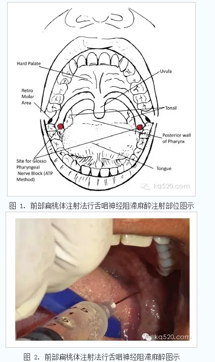 QQ圖片20150715143032.png