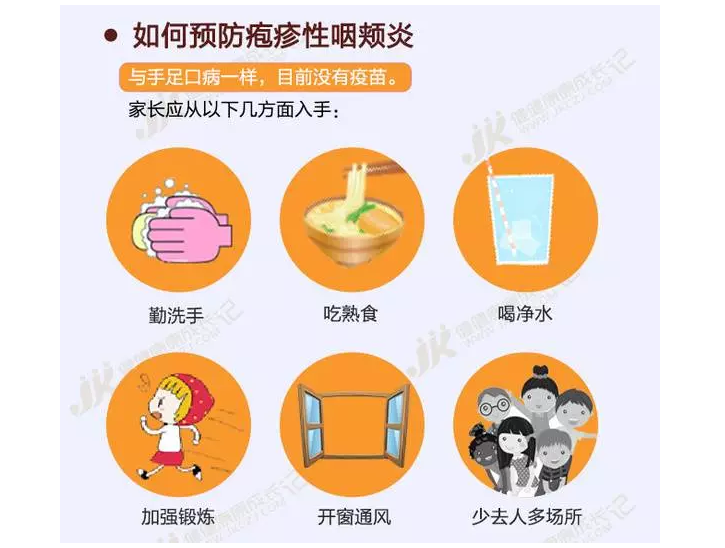 小兒皰疹性咽峽炎的治療和預(yù)防