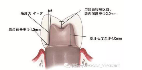 時(shí)常搞不清楚怎么備牙嗎？義獲嘉教您如何完美備牙